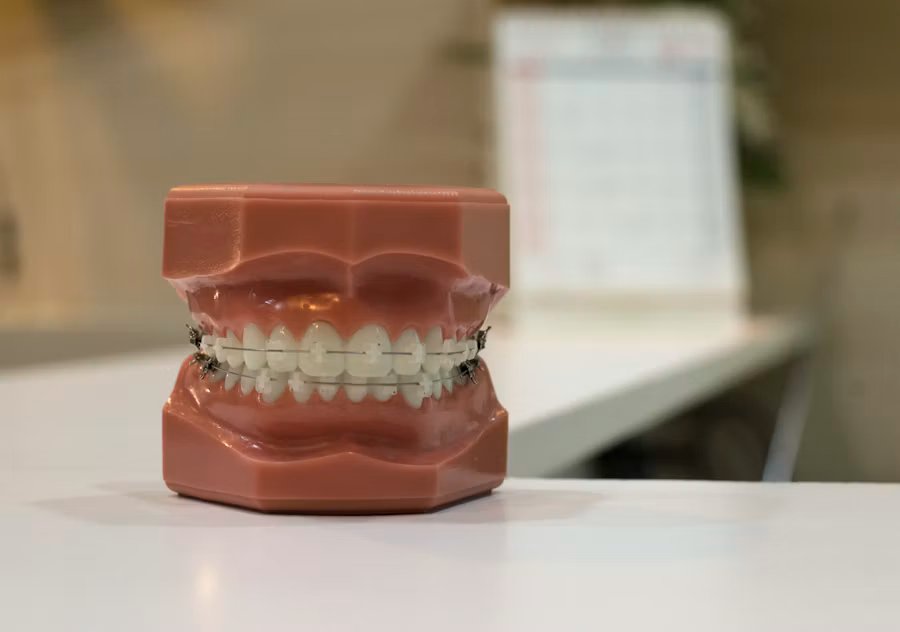 Crown, bridge and denture prosthodontics